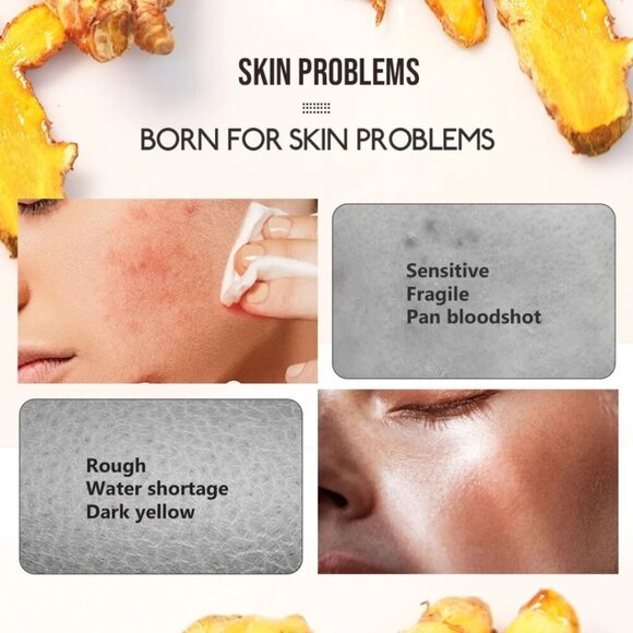 5 Turmeric With Aloe Vera Facial and Body Soap Bar - Picture 3 of 5